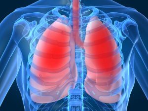 aspergilosis problemas en los pulmones